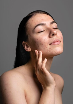 Can Shata Dhauta Ghrita Lighten Dark Spots and Pigmentation?
